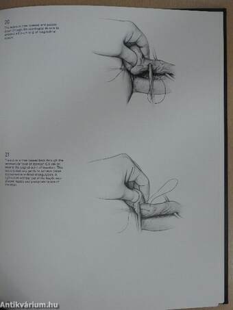 Surgical Techniques Illustrated Spring 1976