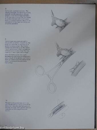 Surgical Techniques Illustrated Winter 1978