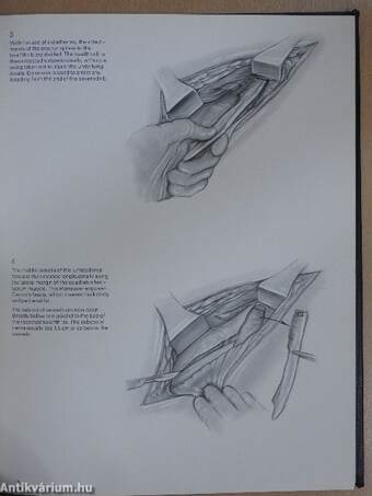 Surgical Techniques Illustrated Winter 1978