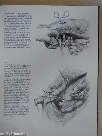 Surgical Techniques Illustrated Spring 1978