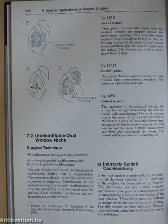 Tympanoplasty, Mastoidectomy, and Stapes Surgery