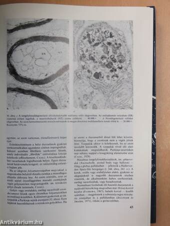 Neuropathologia