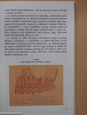 Tájékozódás a fogászati beültetés tudományáról