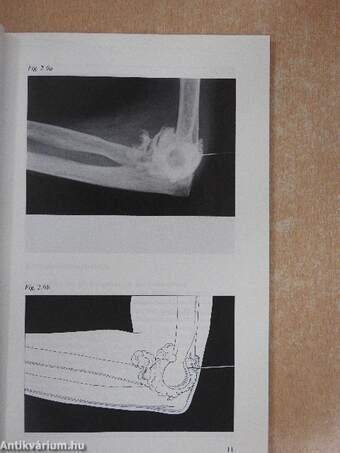 Zur lokalen Injektionstherapie bei rheumatischen Krankheiten Teil 1-11