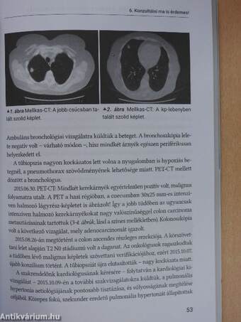 SpringMed Orvosi esettanulmányok - Pulmonológia