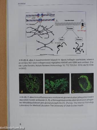 SpringMed Orvosi esettanulmányok - Pulmonológia