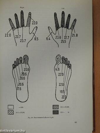 Congenital Limb Deficiencies in Hungary