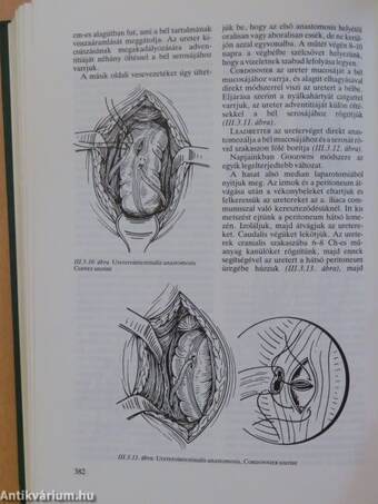 Urológia