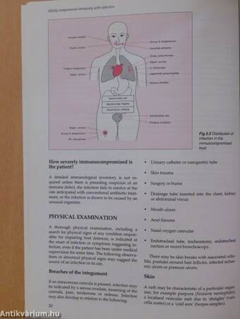 Antimicrobial Therapy in the Immunocompromised Patient