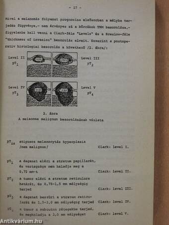 Fej-nyaki daganatok diagnosztikája és terápiája (dedikált példány)