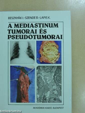 A mediastinum tumorai és pseudotumorai