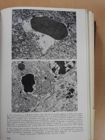 A Szegedi Orvostudományi Egyetem Kórbonctani és Kórszövettani Intézetének közleményei XV. 1969-1973 (dedikált példány)