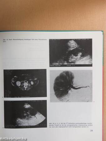 Urosonographische Diagnostik