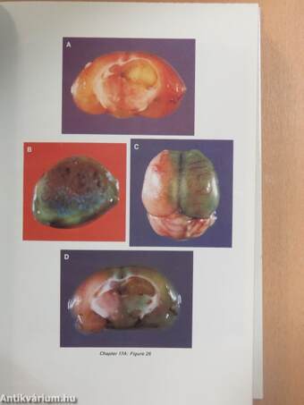 Implications of the Blood-Brain Barrier and Its Manipulation 2.