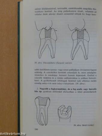 Endodoncia