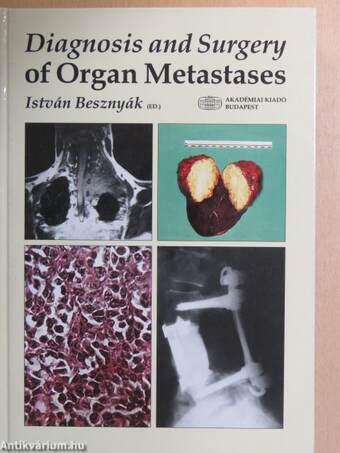 Diagnosis and Surgery of Organ Metastases