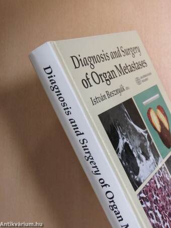 Diagnosis and Surgery of Organ Metastases