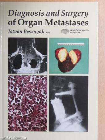 Diagnosis and Surgery of Organ Metastases