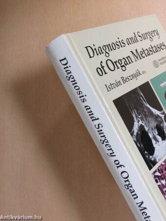 Diagnosis and Surgery of Organ Metastases