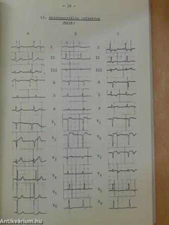 EKG-atlasz