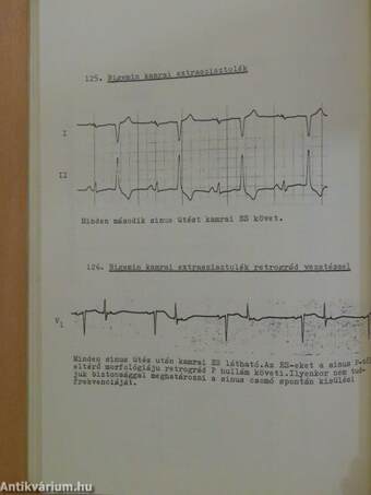 EKG-atlasz