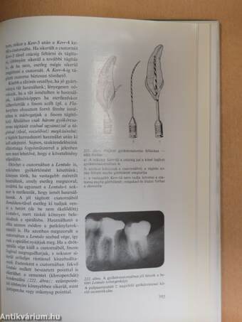 Cariologia és endodontia