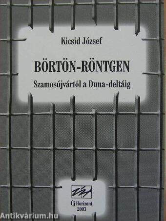 Börtön-Röntgen