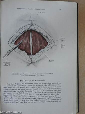 Die Gynäkologischen Operationen und ihre Topographisch-anatomischen Grundlagen