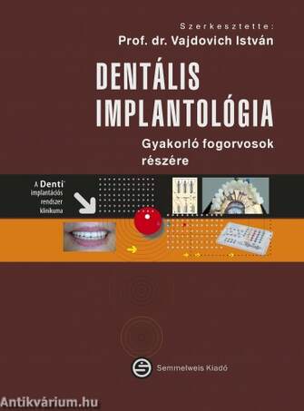 Dentális implantológia - Gyakorló fogorvosok részére