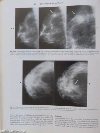 A Concise Textbook of Clinical Imaging