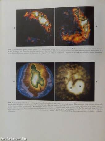 A Concise Textbook of Clinical Imaging