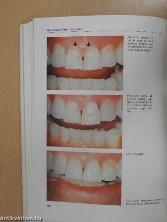 New Concepts in Operative Dentistry