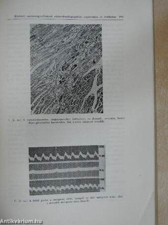 Állatkisérletekben előidézett szívizomgyulladások, azok elektrokardigraphiás registrálása és értékelése az elsődleges fertőzéses gócok szempontjából