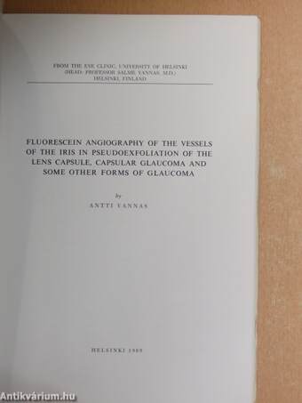 Fluorescein Angiography Of The Vessels Of The Iris In Pseudoexfoliation Of The Lens Capsule, Capsular Glaucoma And Some Other Forms Of Glaucoma