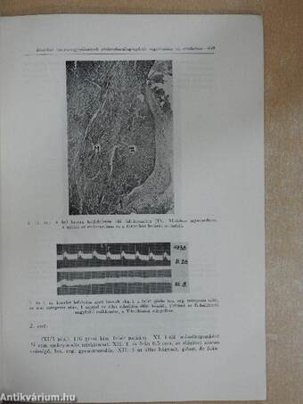 Állatkisérletekben előidézett szívizomgyulladások, azok elektrokardigraphiás registrálása és értékelése az elsődleges fertőzéses gócok szempontjából