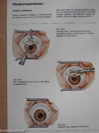 Erkrankungen des Auges 5