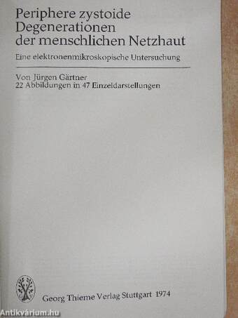 Periphere zystoide Degenerationen der menschlichen Netzhaut