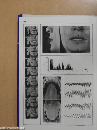 A Conspectus of Russian Speech Sounds