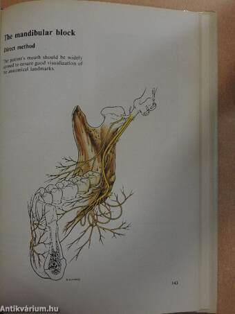 Handbook of Dental Local Anaesthesia