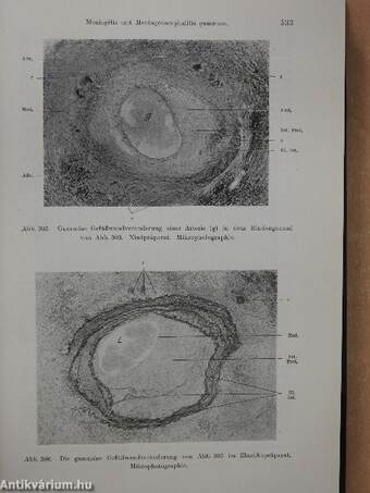 Normale und Pathologische Anatomie und Histologie des Grosshirns II/1.