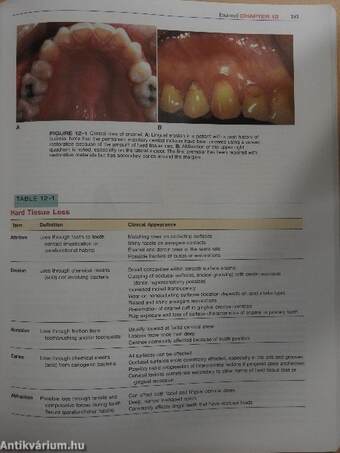 Dental Embryology, Histology and Anatomy