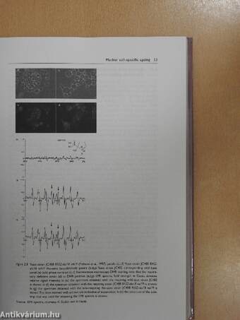 The Metabolism and Molecular Physiology of Saccharomyces cerevisiae