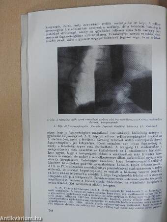 Magyar Radiologia 1961. november