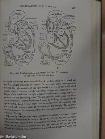 Congenital Malformations of the Heart