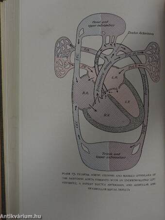 Congenital Malformations of the Heart