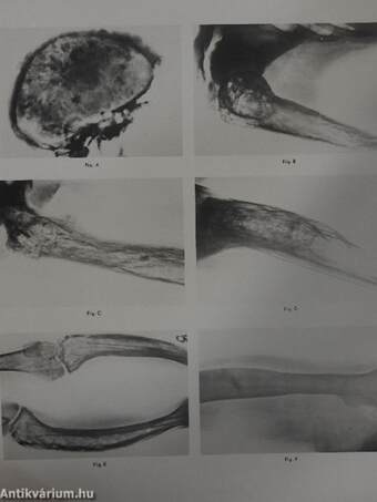 Medical clinics on bone diseases