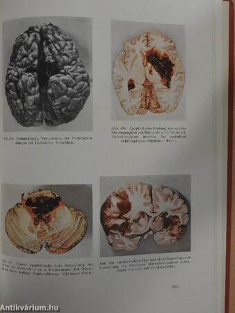 Atlas Der Pathologischen Anatomie