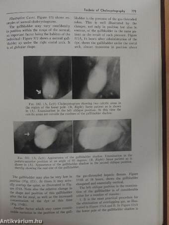 The Digestive Tract in Roentgenology