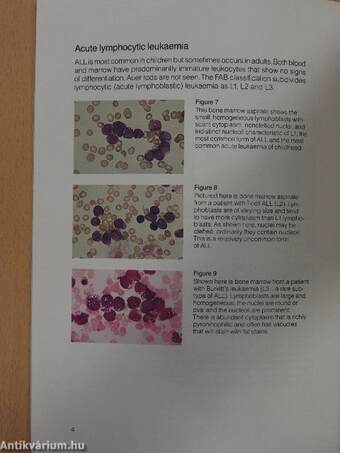 Cancerous and precancerous blood conditions