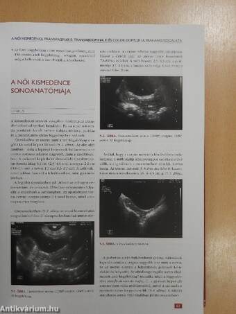 Szülészet-nőgyógyászati ultrahang-diagnosztika